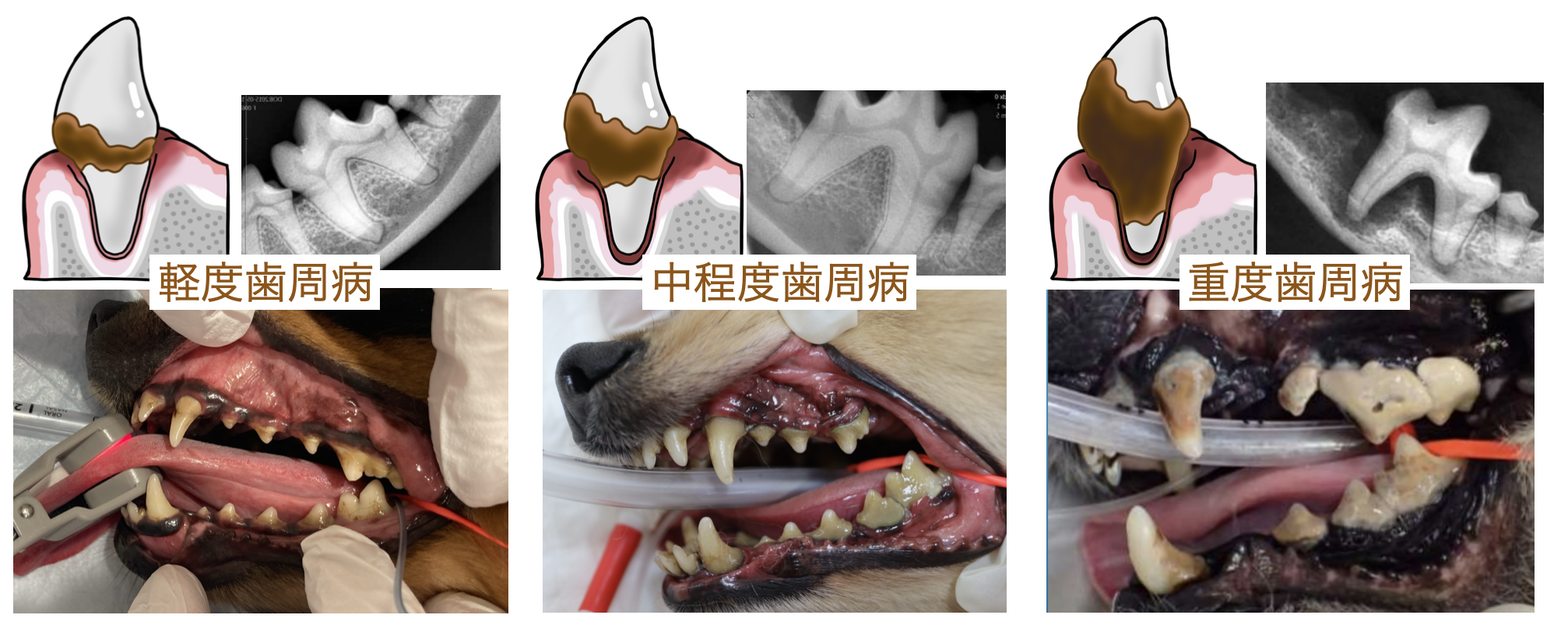 歯科】歯周病が進むとどうなる？放置リスクと進行段 - 東京動物皮膚科