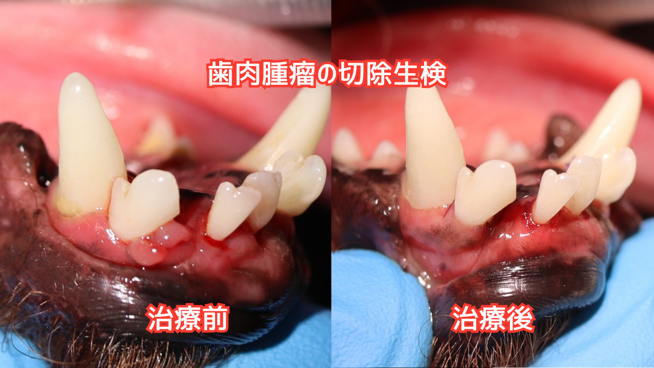 歯肉腫瘤の切除生検