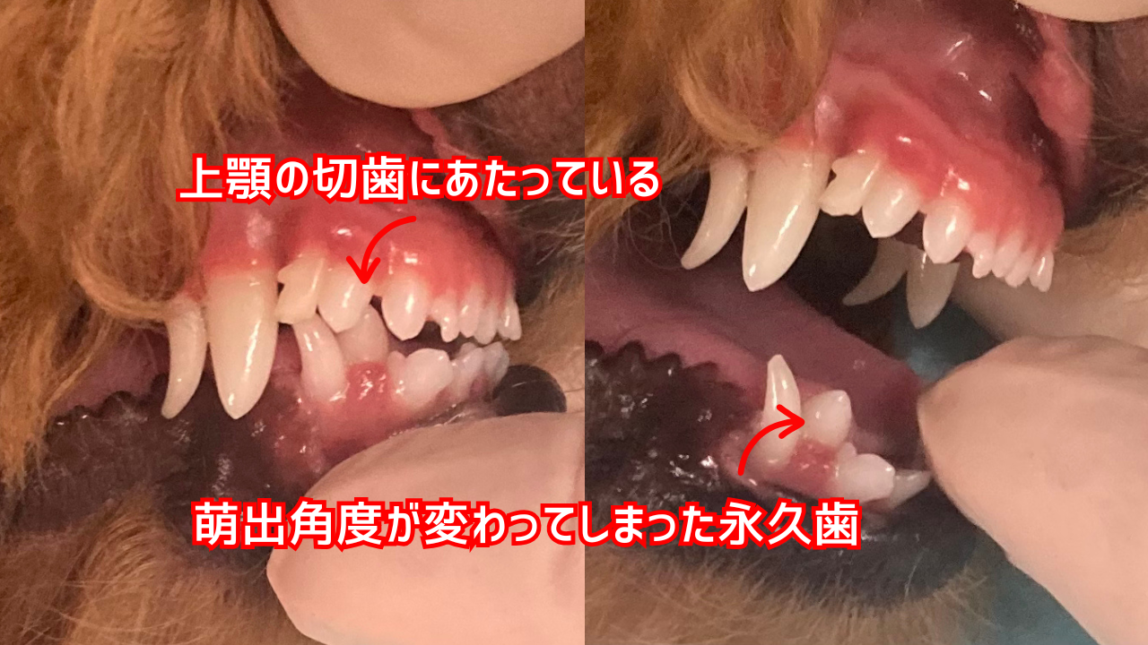 歯の角度が変わり永久歯が上顎の切歯にあたってしまっている犬の口腔写真