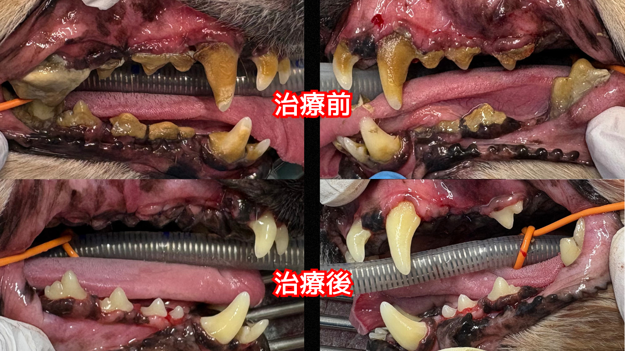 症例の治療前と治療後の写真。抜歯と縫合を行った口腔内の写真。