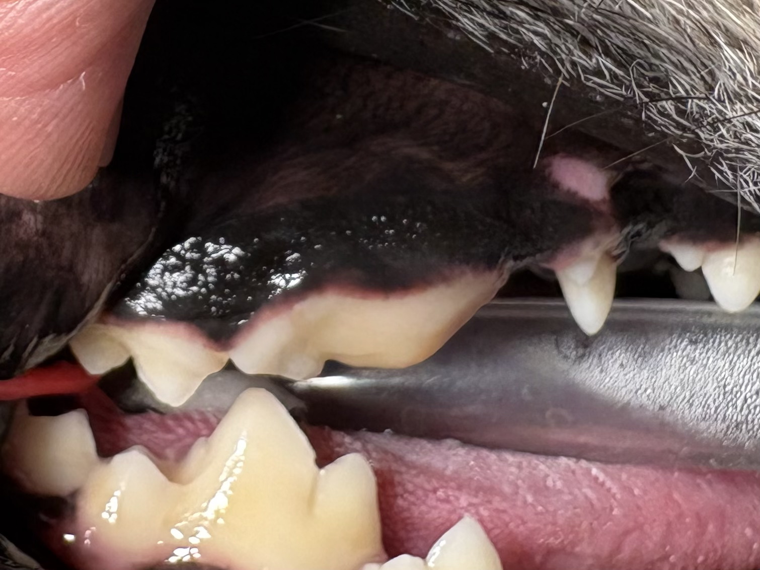 治療後の奥歯の写真