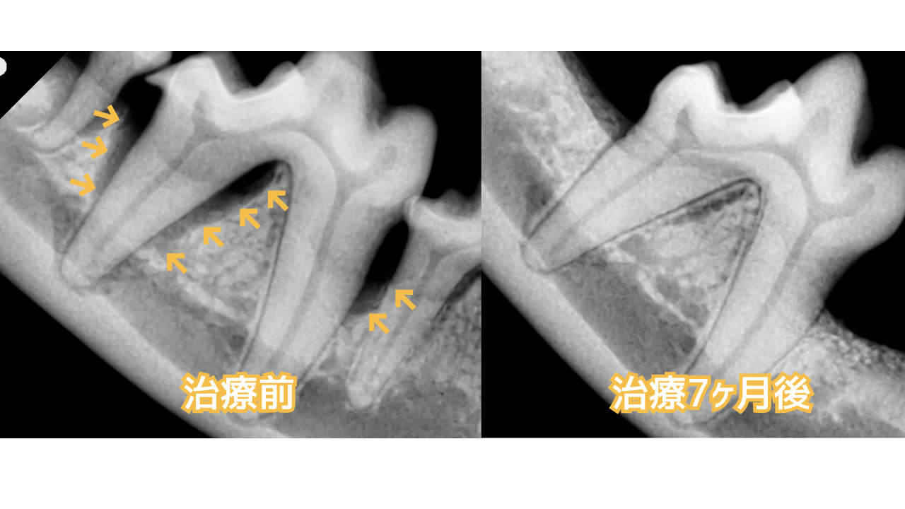 犬の下顎大臼歯、治療前と治療後7ヶ月後の歯科レントゲンの比較写真