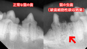 猫の虫歯と正常な歯のレントゲン写真