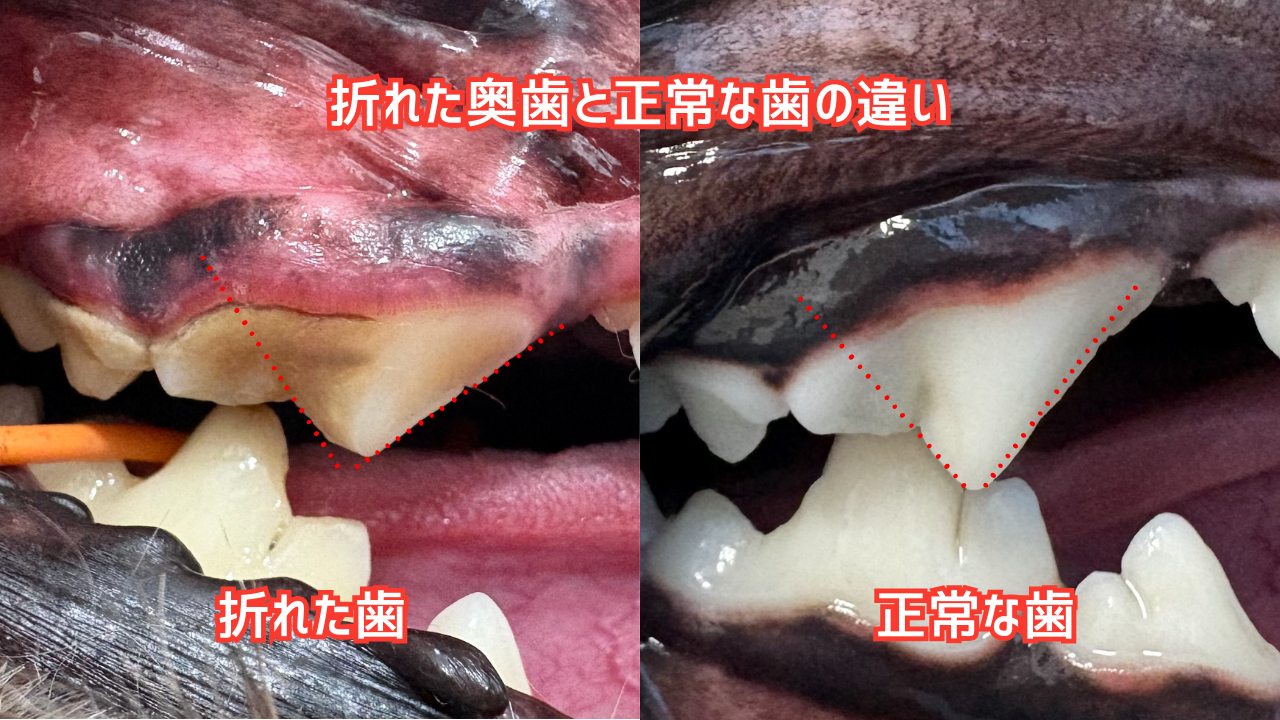 折れた歯と正常な歯の比較写真