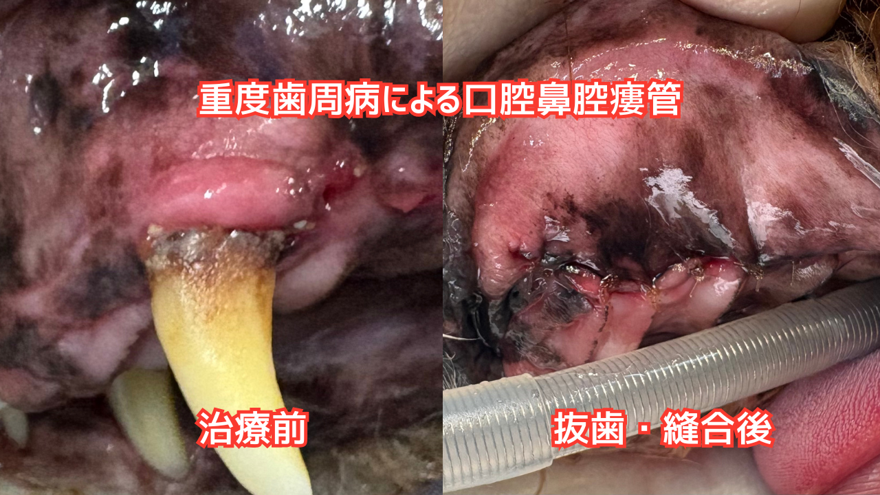 口腔鼻腔瘻に対する治療の比較写真。