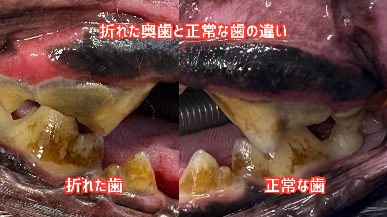 折れた歯と健康な歯の比較写真
