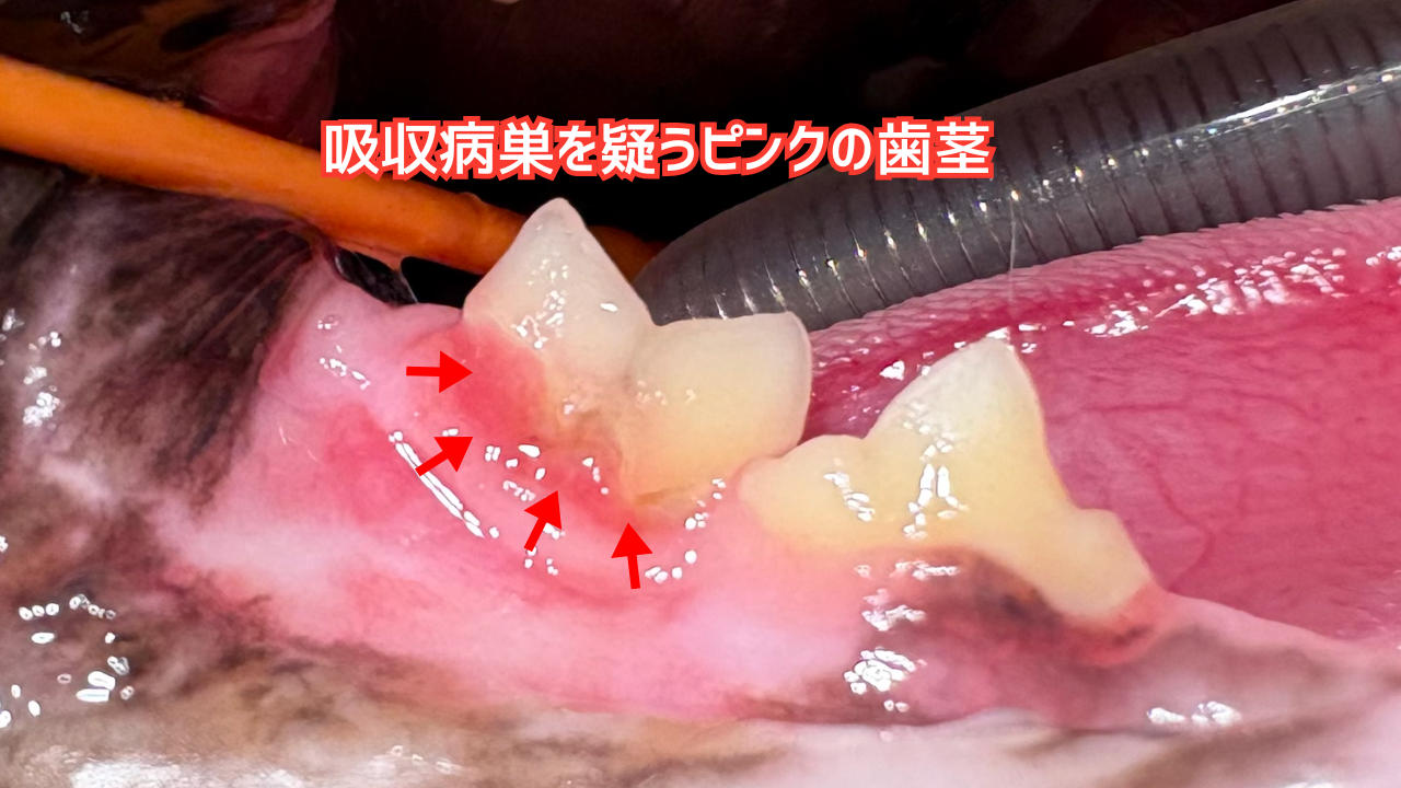 吸収病巣を疑うピンクの歯茎の増生を認める。