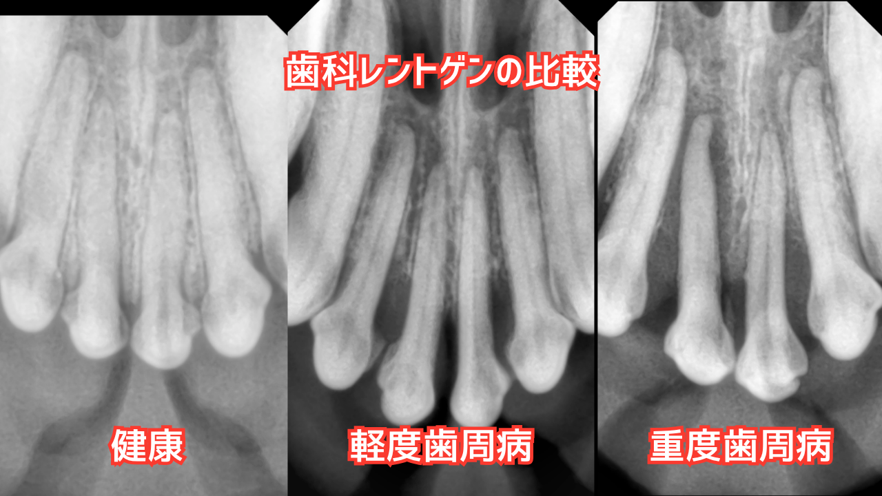 犬の前歯の歯科レントゲン比較