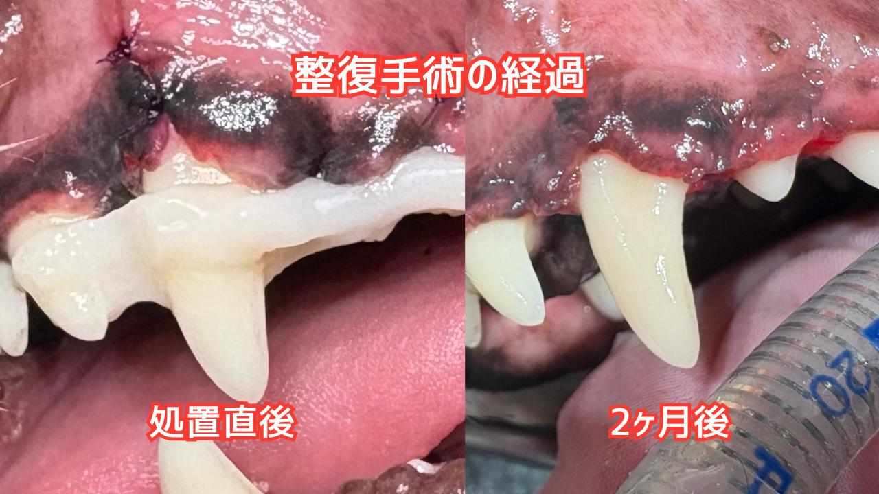整復手術後の経過の前後比較写真