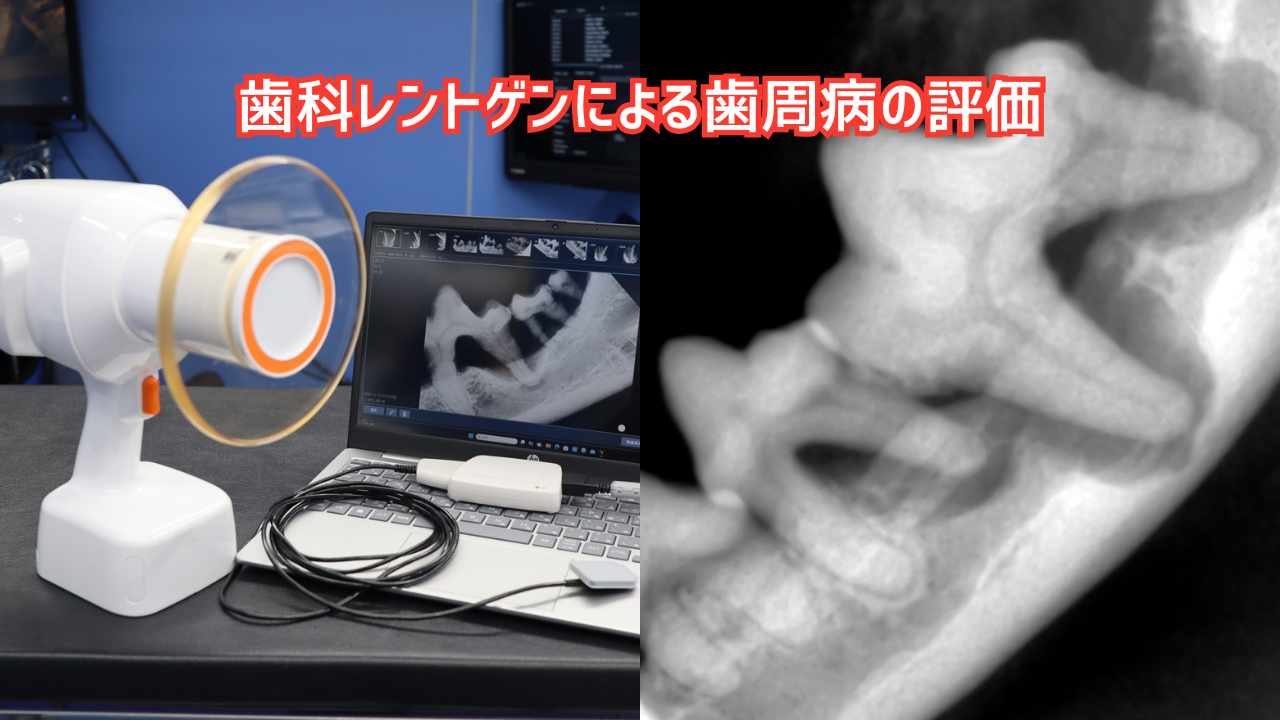 歯科レントゲン機器とレントゲン写真