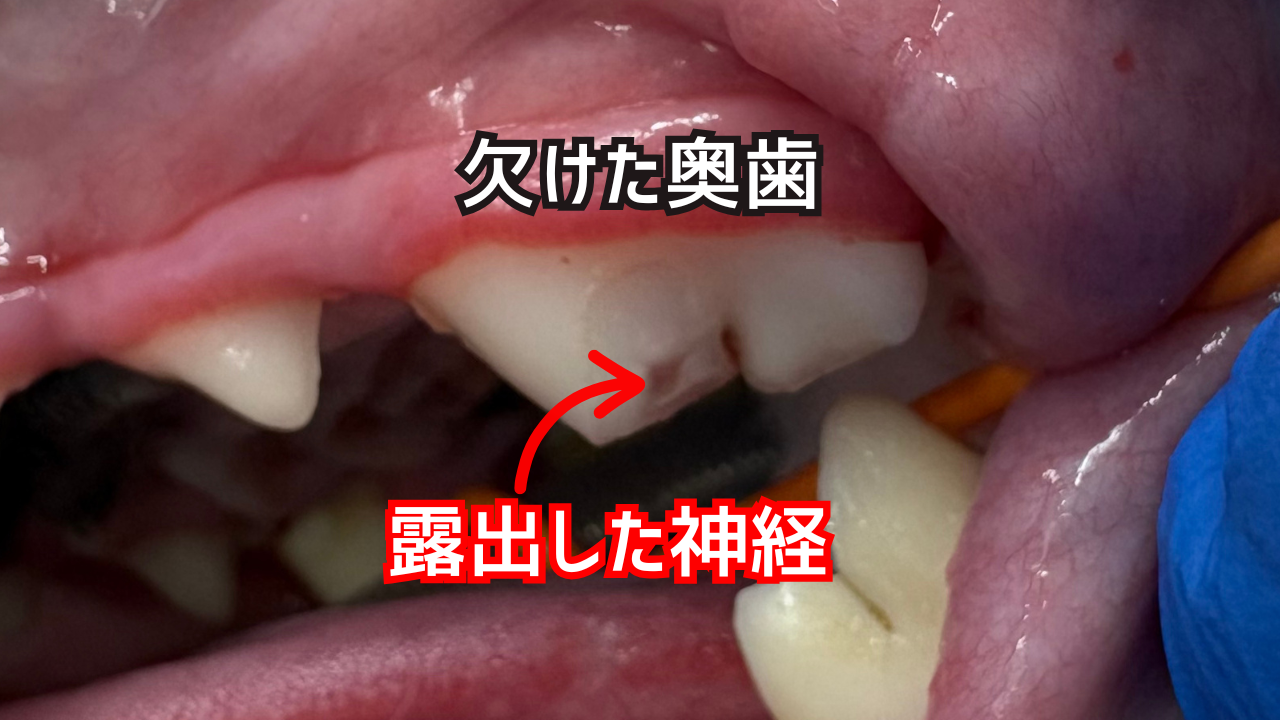 犬の欠けた奥歯(左上顎第四前臼歯の複雑破折)と露出した神経